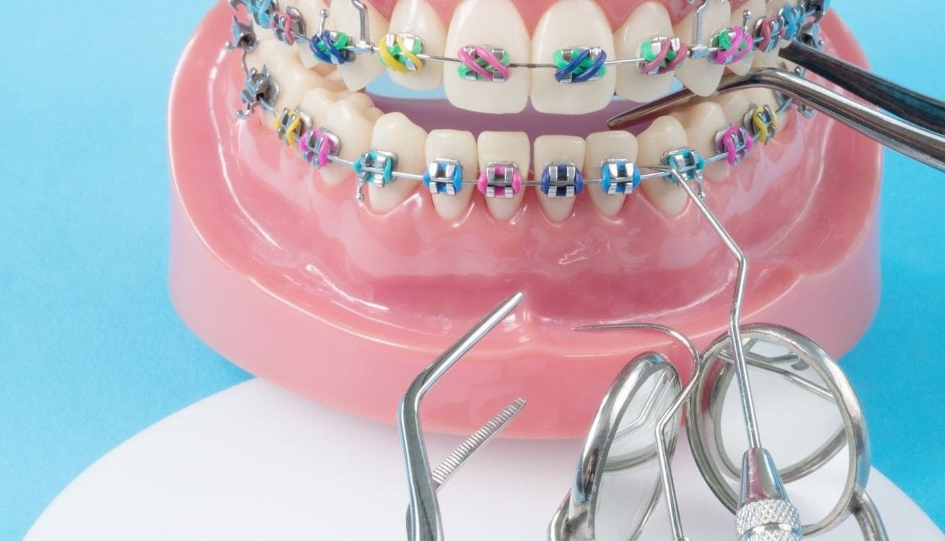 Ортодонтія